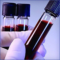 Silver Laboratory blood test