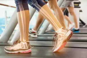 Exercise options for osteoporosis